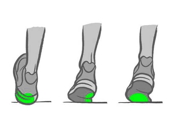 Pronatie infographic - RunX